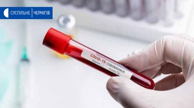 За минулу добу на Чернігівщині підтвердили 2 випадки захворювання коронавірусом