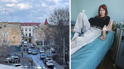 14-річній дівчині, на яку напали у центрі Житомира, погрожують