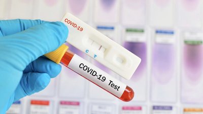 На Херсонщині за добу на COVID-19 захворіло 293 людини, 14 померло
