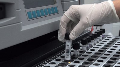 На Житомирщині зафіксовано 22 нових випадки захворювання на COVID-19