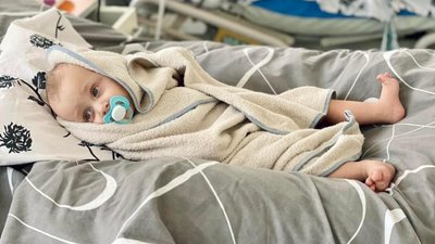 Дитина після операції Дитина після операції