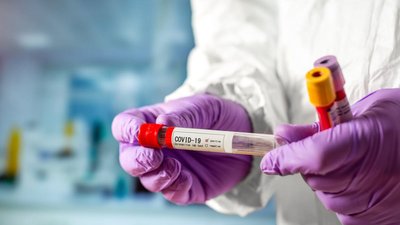 На Херсонщині за добу виявили 304 нових випадків захворювання на COVID-19
