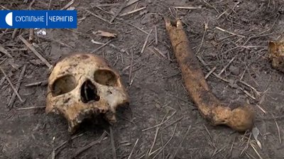 Жителька Сосницького району знайшла на городі людські черепи та кістки часів II світової війни