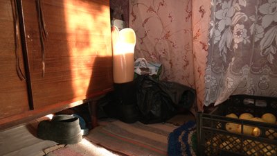 Старий для городу, новий — "на вихід": 74-річній пенсіонерці з Анисова замінили протез Старий для городу, новий — "на вихід": 74-річній пенсіонерці з Анисова замінили протез