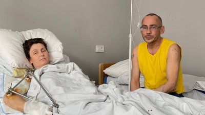 "У мене забрали все". Історія жительки Попасної, яка травмувалася через падіння снаряду