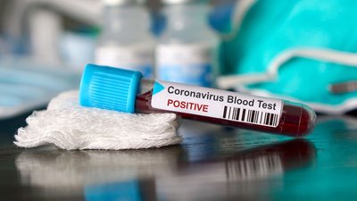 За добу на Чернігівщині +456 хворих на коронавірус