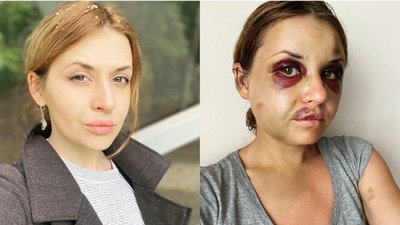 Чоловік побитої жінки з потяга Маріуполь-Київ: "Дружині стало гірше, сину потрібна терапія"