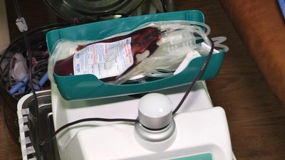 Найбільша потреба – в четвертій групі крові, а також у всіх групах із негативним резус-фактором Найбільша потреба – в четвертій групі крові, а також у всіх групах із негативним резус-фактором