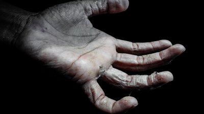 Як доглядати за шкірою після використання мила, санітайзера і носіння маски Як доглядати за шкірою після використання мила, санітайзера і носіння маски