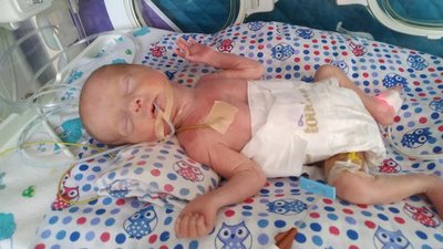 Львівські лікарі врятували двійню, яка народилася на 7 місяці вагітності Львівські лікарі врятували двійню, яка народилася на 7 місяці вагітності