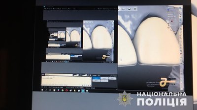 На Дніпропетровщині злочинці зламували захист програм для стоматології – поліція