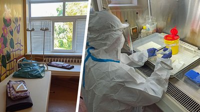 Медична бригада і палати. У Кропивницькому готуються до можливого спалаху мавпячої віспи
