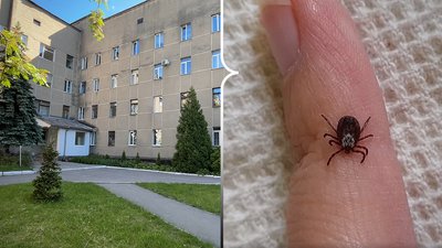 Вперше за 15 років на Рівненщині зафіксували випадок кліщового енцефаліту