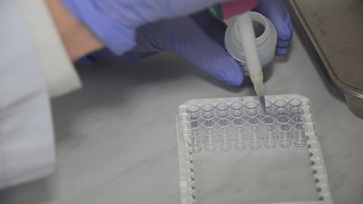 У Тернопільському ОЛЦ можуть протестувати на імунітет до коронавірусу усіх бажаючих У Тернопільському ОЛЦ можуть протестувати на імунітет до коронавірусу усіх бажаючих