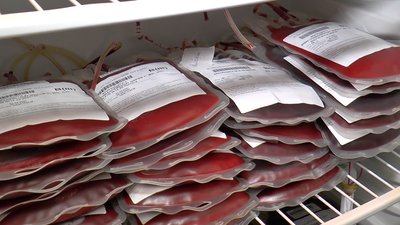 За день збору отримали приблизно 20 літрів крові За день збору отримали приблизно 20 літрів крові