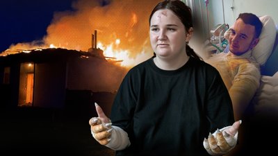 БпЛА влучив у будинок у Чернігові: поранена Єлизавета згадує перші хвилини після влучання 