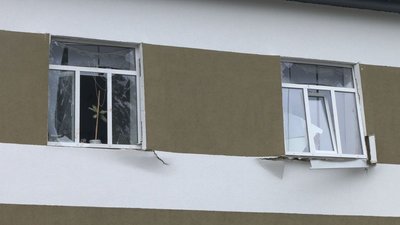 Перебувають у комі: що відомо про стан травмованих від вибуху гранати у «Десні»