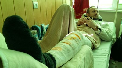 “Коли я прокинувся — на нозі були спиці". З відкритим переломом в Ужгороді лікується Ігор з Київщини “Коли я прокинувся — на нозі були спиці". З відкритим переломом в Ужгороді лікується Ігор з Київщини