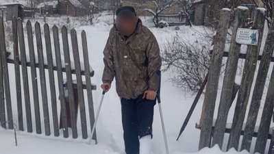 Чоловік із поламаною ногою