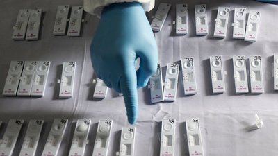 На Чернігівщині Covid-19 діагностували у 255 людей, чотирнадцять людей померли
