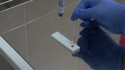 Де в Черкасах можна безоплатно здати тест на ВІЛ Де в Черкасах можна безоплатно здати тест на ВІЛ