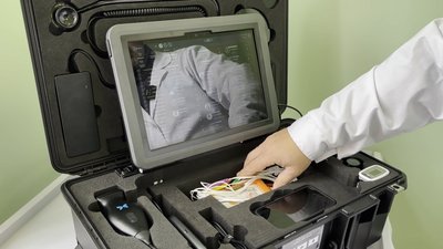 Телемедицина: обладнання на Чернігівщині