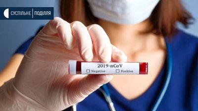 COVID-19 на Хмельниччині: 7 нових випадків інфікування