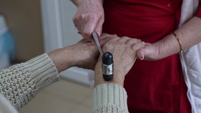 Як розпізнати інсульт та які на Полтавщині є можливості для лікування хвороби