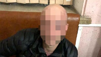 У Рівному під час затримання "дебошира" поліцейському зламали пальця та побили У Рівному під час затримання "дебошира" поліцейському зламали пальця та побили