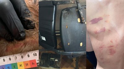 Побиття залізним стільцем: ДБР повідомило про підозру черкаським правоохоронцям