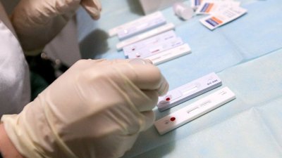 Тестування на вірусні гепатити В і С