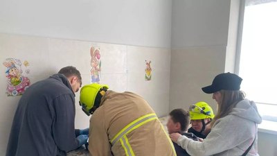 Рятувальники зняли металеве кільце, яке стиснуло палець 15-річного хлопця, на Рівненщині
