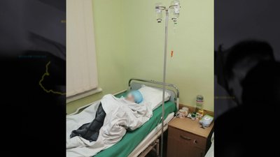 Молодшу сестру оперували 4 години: подробиці нападу собаки на дітей на Чернігівщині