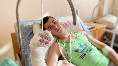 Руку переїхав віз: у Львові лікарі врятували кисть 17-річному хлопцю