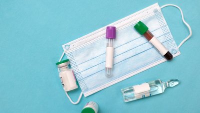 3 міста і 13 районів Житомирської області увійшли до "жовтої" зони поширення COVID-19