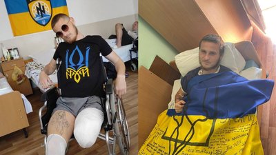 Військовослужбовець втратив ногу Військовослужбовець втратив ногу
