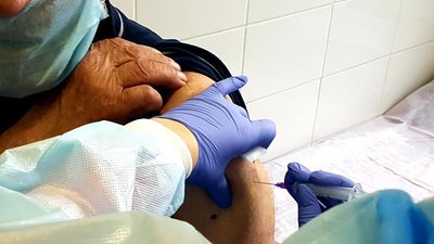 На Одещині розпочали щеплення китайською вакциною CoronaVac На Одещині розпочали щеплення китайською вакциною CoronaVac