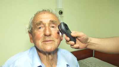 Всесвітній день боротьби з меланомою: у Вінниці обстежили майже пів сотні людей Всесвітній день боротьби з меланомою: у Вінниці обстежили майже пів сотні людей