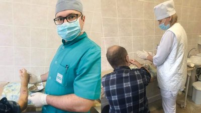 Пальці працюють: у луцькій лікарні показали результат реплантації руки