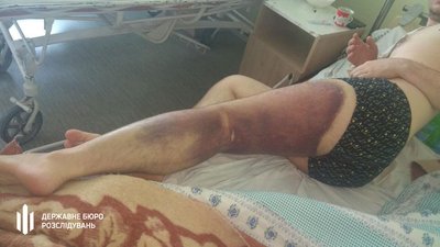 Шестеро миколаївських поліцейських опинилися на лаві підсудних за катування чоловіка Шестеро миколаївських поліцейських опинилися на лаві підсудних за катування чоловіка