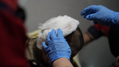 поранена внаслідок удару