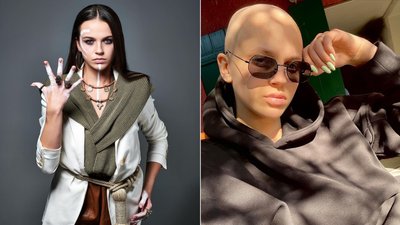 "Пройшла через пекло, але зараз почуваю себе прекрасно". Історія гімнастки Узвяк, яка поборола рак "Пройшла через пекло, але зараз почуваю себе прекрасно". Історія гімнастки Узвяк, яка поборола рак