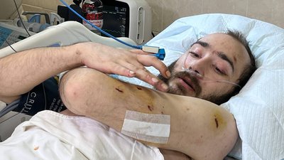 Поступився побратиму своїм місцем на евакуації: на Дніпропетровщині лікують пораненого військового Поступився побратиму своїм місцем на евакуації: на Дніпропетровщині лікують пораненого військового