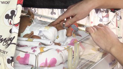 У Житомирі у відділенні реанімації новонароджених відкрили палати перебування матері і дитини У Житомирі у відділенні реанімації новонароджених відкрили палати перебування матері і дитини