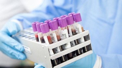 На Чернігівщині за добу на коронавірус захворіло 29 людей, 11 одужали