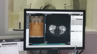 Нове рентгенологічне відділення у 2-й міській лікарні Полтави: які обстеження можна пройти Нове рентгенологічне відділення у 2-й міській лікарні Полтави: які обстеження можна пройти