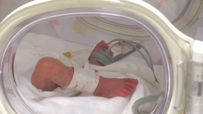 У Франківському обласному перинатальному центрі оновили відділення інтенсивної терапії новонароджених У Франківському обласному перинатальному центрі оновили відділення інтенсивної терапії новонароджених
