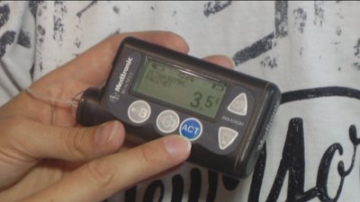 У Вінниці створили відеошколу для хворих на діабет У Вінниці створили відеошколу для хворих на діабет