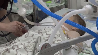 У Харкові пораненого під час російського обстрілу хлопчика підключили до ШВЛ У Харкові пораненого під час російського обстрілу хлопчика підключили до ШВЛ