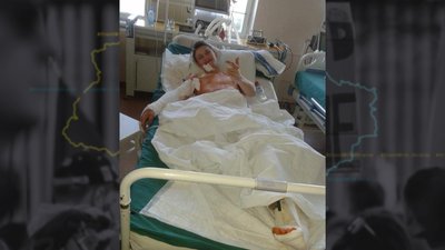 Олександр Півнєв після поранення Олександр Півнєв після поранення